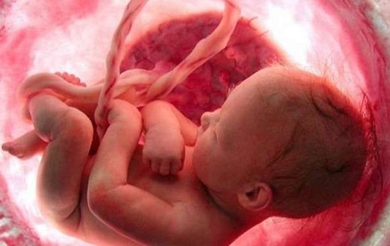 Melahirkan Seorang Diri, Kepala Bayi Putus Tertinggal di Rahim Ibunya, Begini Kronologisnya...
