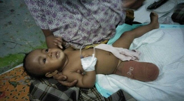 TRAGISSS...Dibonceng Ibu Naik Ojek, Kaki Bayi Perempuan 6 Bulan Ini Putus setelah Gendongannya Terlilit Gir Motor