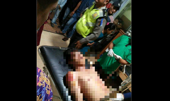BRAKKK...Tabrak Truk yang hendak Belok, Pelajar SMPN 8 Bathin Solapan-Bengkalis Tewas, Temannya Kritis