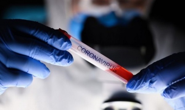 BREAKING NEWS:  Hasil Rapid Test  di Dumai,  7 Orang Positif, Seorang Diantaranya Dokter, Gugus Tugas Tunggu Hasil Swab