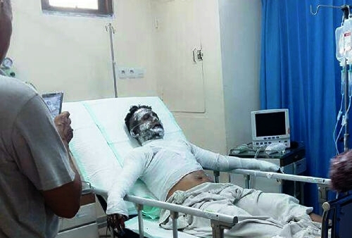 DUARRR... Tubuh dan Wajah Alnofia Terbakar saat Potong Drum Kosong