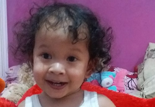 Kenali Tanda Tongue-Tie pada Bayi Beserta Cara Menanganinya