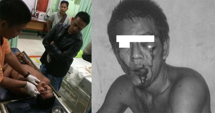 ALAHMAKKK...Dikira Maling, Babak Belur Dihajar Massa di Kampus UR, Pria Ini Ternyata 'Tetangga Sebelah'