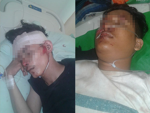 Brakkk! Ditabrak Mobil Korban, Dua Sekawan Diduga Komplotan Jambret Ini Sekarat