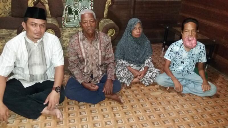 MOHON BANTUAN...Zamri, Penderita Tumor Mulut di Rohil Butuh Dana Besar untuk Biaya Operasi