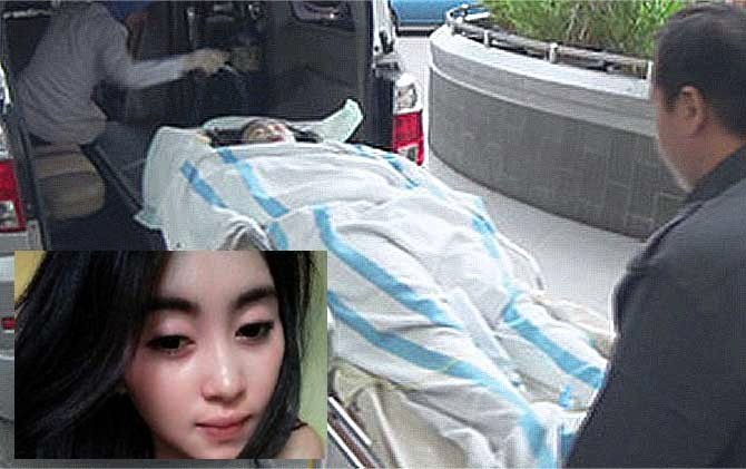 Parah, Begini Kondisi Wanita Cantik yang Disiram Pakai Air Keras oleh Pacarnya