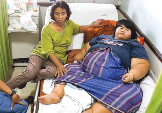 Alahmak! Doyan Makan Sejak Kecil, Bobot Yunita Naik Jadi 142 Kg