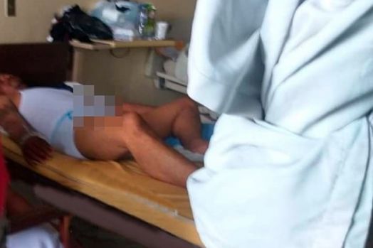Konyol! Gara-gara Minum 'Obat Kuat' untuk Sapi, Penis Pria ini Ereksi 3 Hari Hingga Harus Operasi