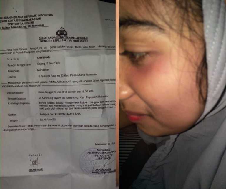 GANAS...Tagih Utang Rp 8 Juta, Dua Mahasiswi Cantik Malah Lebam-lebam Dianiaya Oknum PNS