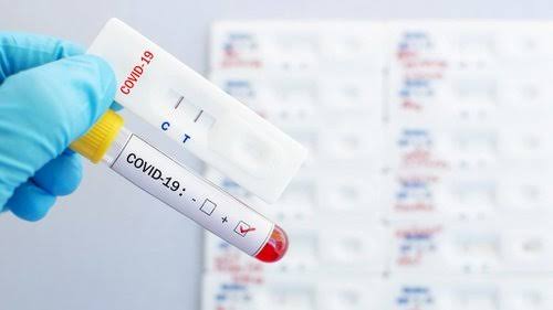 Bertambah 2.743, Kini Sudah Ada 174.796 Kasus Positif Covid-19 di Indonesia