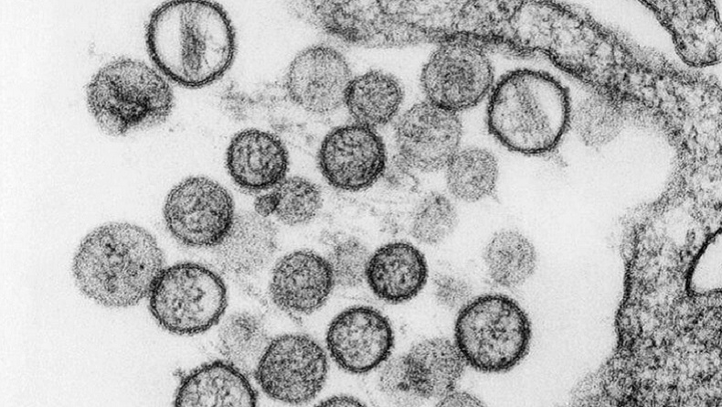 Gawat! Corona Belum Selesai, Muncul Virus Baru di Yunan-China, Namanya Hantavirus