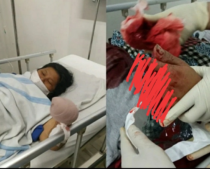 Gila! Pedagang Ini Ngaku Dibegal, Padahal dengan Sengaja Potong Jari-jarinya karena Terlilit Utang, Begini Cerita Rekayasanya