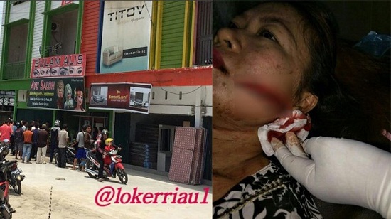 Luka-luka Selepas Diserang Dua Rampok,  Yayu Sempat Kejar Pelaku dan Minta Tolong Warga