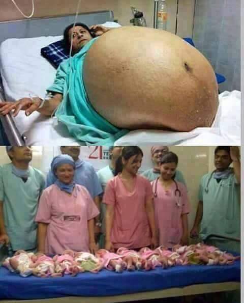 HEBOHHH...Lahirkan Bayi Kembar 10, Foto Perut Besar Wanita Ini Jadi Viral di Medsos
