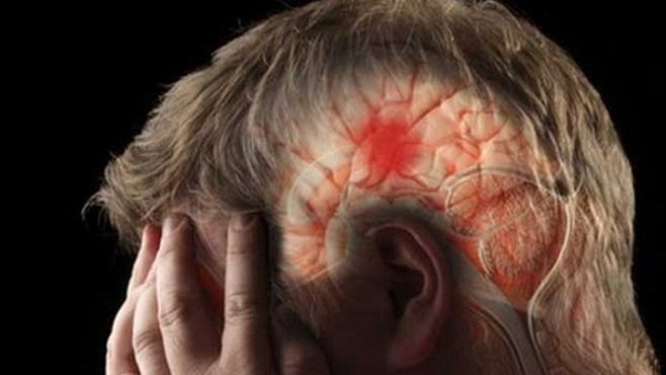 Selain Pusing Berat, Ini Gejala Stroke Ringan Yang Perlu Kamu Ketahui...