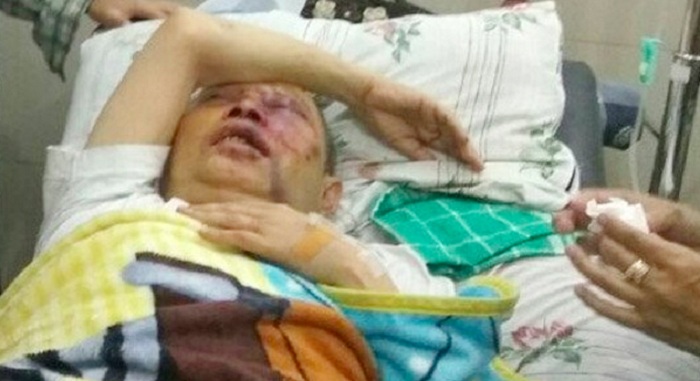 Usai Shalat Subuh, KH Umar Basri Dianiaya OTK dalam Masjid, Begini Kondisinya