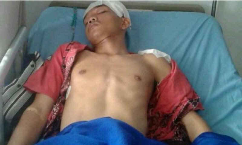 SADIS...Mahasiswa Ini Nyaris Tewas Usai Kepalanya Dibacok Pakai Parang Pemotong Daging