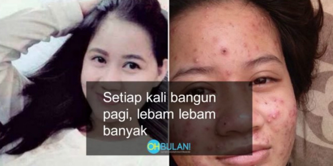 KATANYA DISANTET, Wajah Cantik Wanita Ini Berubah Menyeramkan dan Bernanah