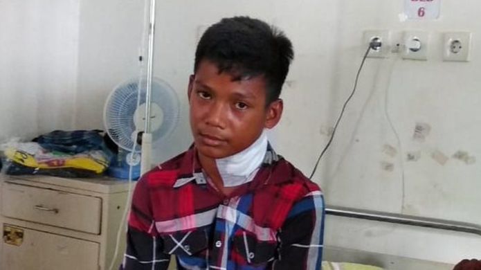 Moncong Ikan Marlin Tembus Leher, Idul: Sakit Sekali, Apalagi Kalau Saya Gerakkan Leher