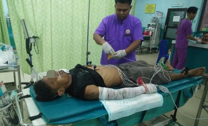 MALING TOLOL...Nekat Curi Kabel Grounding Tegangan Tinggi, Pelaku Justru Terkapar dan Alami Luka Bakar