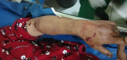 Hasnati Luka-luka Diserang Saat Berwudhu', Buayanya Mati Dihajar Warga