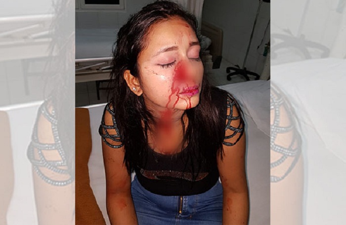 KEJAMNYA... Dikeroyok, Diseret dan Dihajar Pakai High Heels, Wajah Wanita Cantik Ini Berlumuran Darah