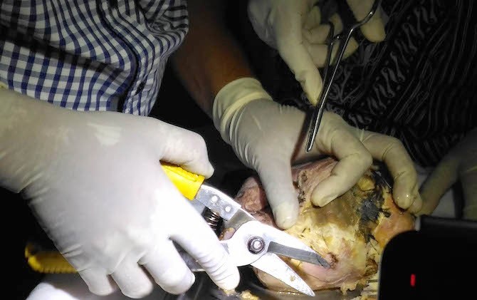 Kisah Nyata... Nenek 60 Tahun di Jambi Melahirkan Bayi Berusia 37 Tahun