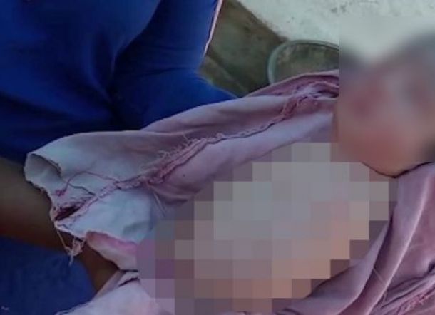 Langka! Saat Hamil Dokter Pastikan Normal, Tapi Pas Lahir Bayi Ini Tak Punya Kaki dan Tangan