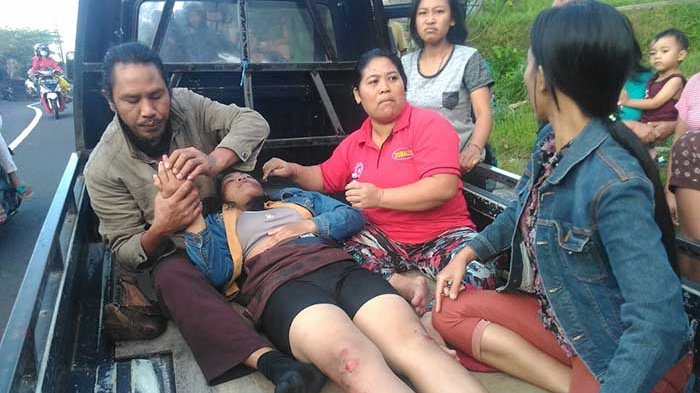 BRAKKK...Hantam NMax, Siswi SMA Terluka Hingga Bibir Atas Robek 