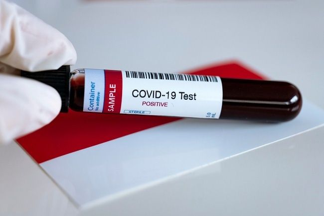 3.997 ODP di Riau Sudah Dilakukan Rapid Test, Hasilnya...