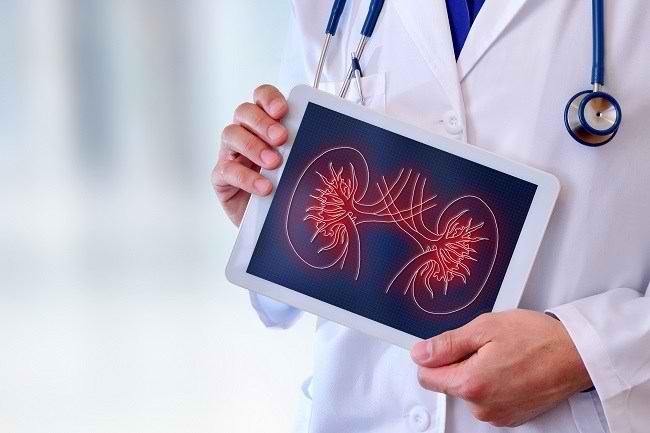 Biopsi Ginjal, Ini yang Harus Anda Ketahui