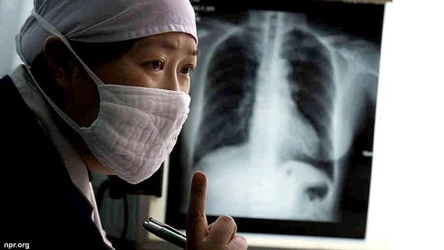 TRAGIS, Pria Ini Batuk Hingga Sebagian Isi Paru-parunya Ikut Keluar