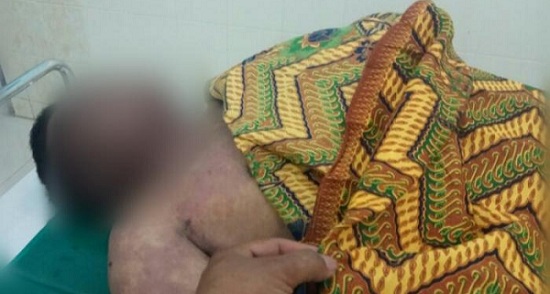 Diduga Kesetrum Listrik, Karyawan Hotel Cititel Dumai Meninggal