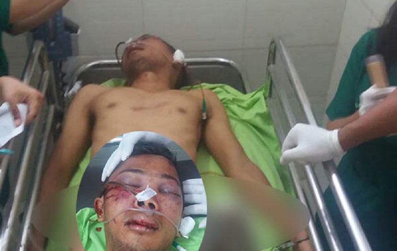 TEGANYA...Tertangkap Basah Mencuri, Pria Tanpa Identitas Ini Tewas Dihajar Massa, Berdarah-darah