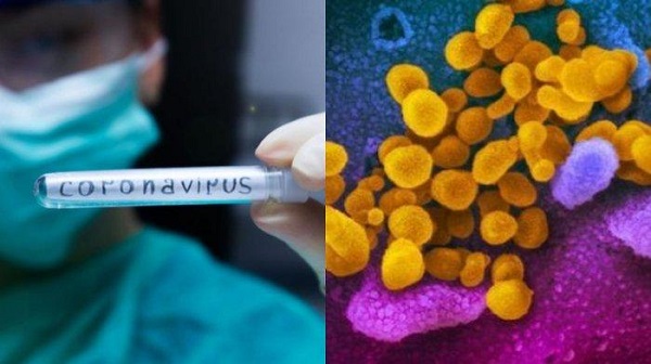 WASPADA! Lebih Kuat dari SARS dan Covid-2, Mutasi Baru Virus Corona Ini Penularannya 10 Kali Lebih Cepat