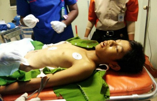 Tabrakan Maut  Mobil Diduga Perwira Polisi dan Motor Dua Pelajar MTs di Lipat Kain, Satu Tewas