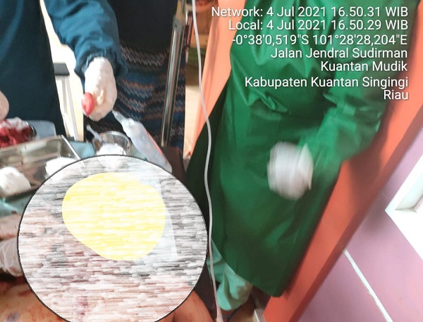 Polisi Masih Lakukan Pengejaran Pelaku Pembacokan di Kuantan Mudik