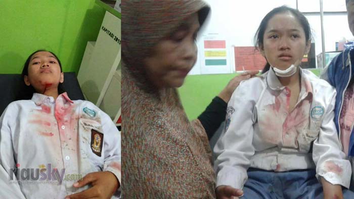 HEBAT...Nekat Lawan Perampok di Angkot, Siswi SMK Ini Sampai Berdarah-darah, Nih Fotonya