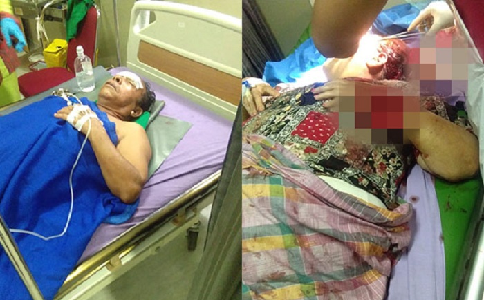 Baru Keluar dari RS Jiwa, Hasudungan Mengamuk Saat Diteriaki Maling, 3 Warga Dibacok, Berdarah-darah 