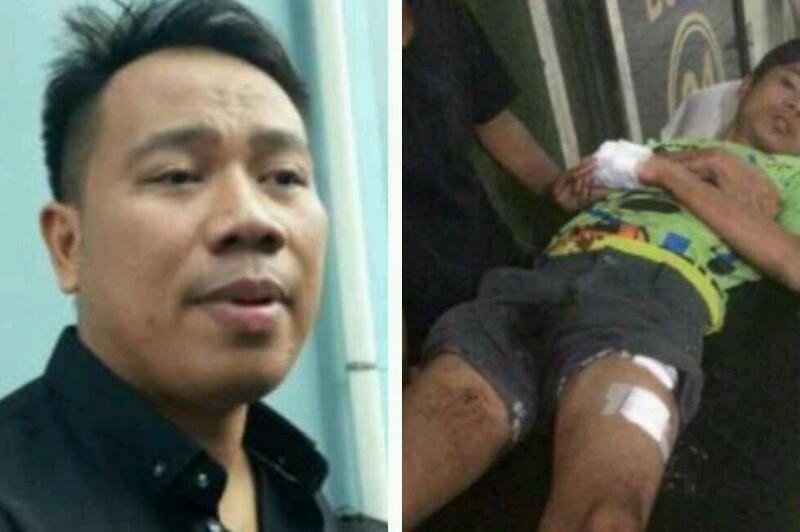 Ini Benaran Bukan Setingan, Adik Vicky Prasetyo Jadi Korban Pengeroyokan dengan Senjata Tajam