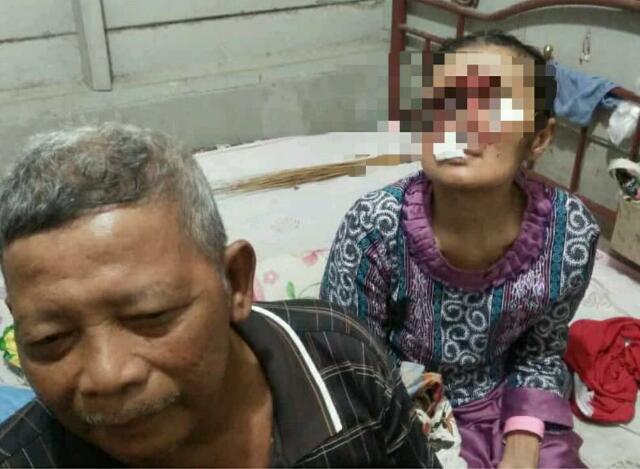 Dikira Cuma Tahi Lalat, Kanker Kulit Renggut Penglihatan Rukiah, Warga Rohil Ini Butuh Bantuan