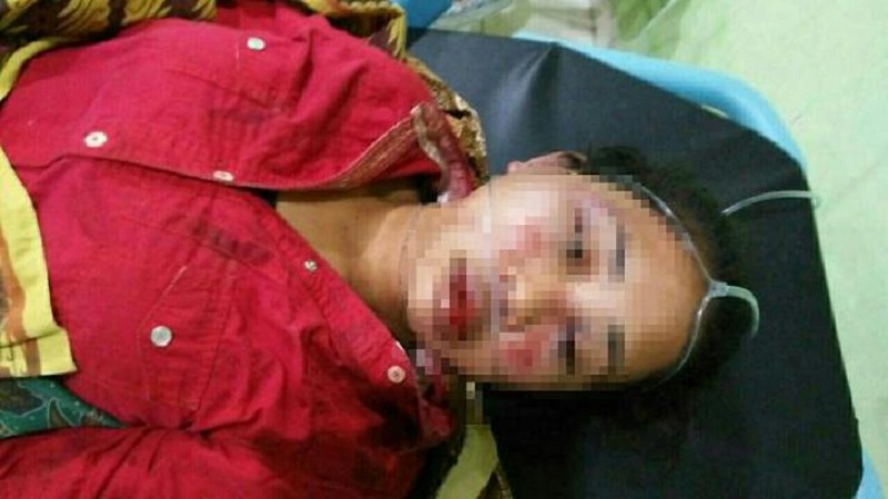 JAHAT...Nurul Najwa Babak Belur Dihajar Kekasih Tercinta, Luka-luka dan Lebam di Wajah