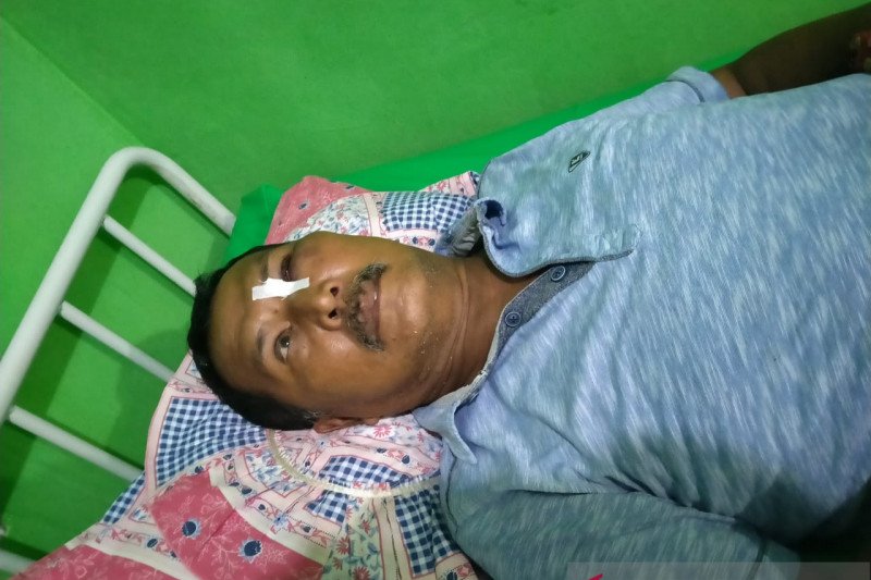 Sosialisasi Corona ke Warung Domino, Kepala Kampung Koto Rawang Lebam-lebam Dianiaya