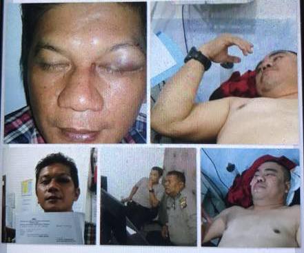 Aniaya Pengurus Partai, Anggota DPRD Riau Dilaporkan ke Polisi