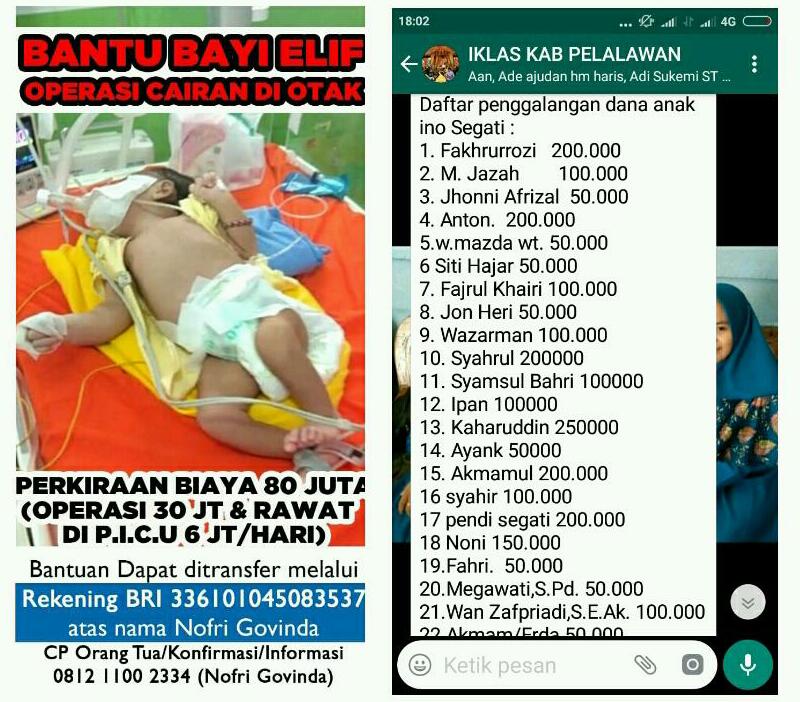 MOHON BANTUAN...Desvita Bayi Pengidap Infeksi Otak di Segati Pelalawan harus Segera Dioperasi 