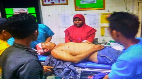 Siswa SMKN 1 Kelayang Tewas Luka-luka Akibat Dikeroyok