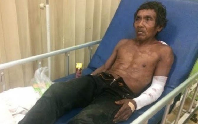 Duel dengan Buaya Sungai, Kakek Arman Alami Luka Parah
