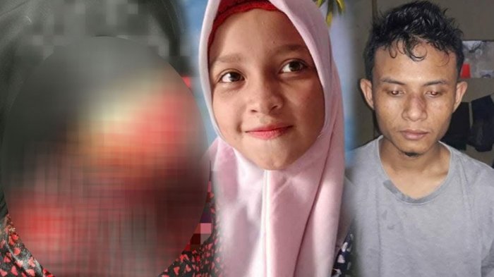 SADIS...Cemburu, Wajah Firda Maisura, Gadis Cantik Dibacok Pacarnya Sendiri Pakai Parang