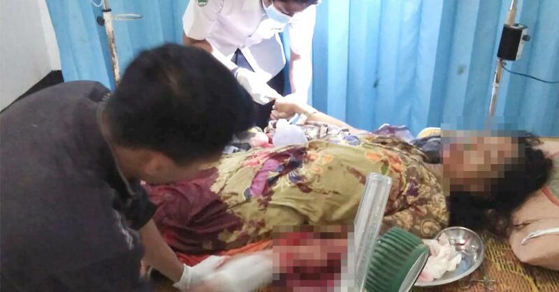 SADIS...Rohini dan  Rosmiati Nyaris Tewas Disabet Parang Milik Perampok Bercadar
