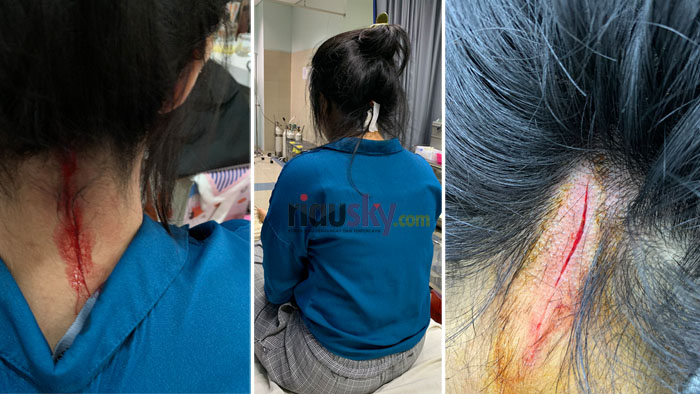 Pelaku yang Menyilet Perempuan Muda di Jembatan Penyeberangan Orang Ditangkap, Ini Orangnya!